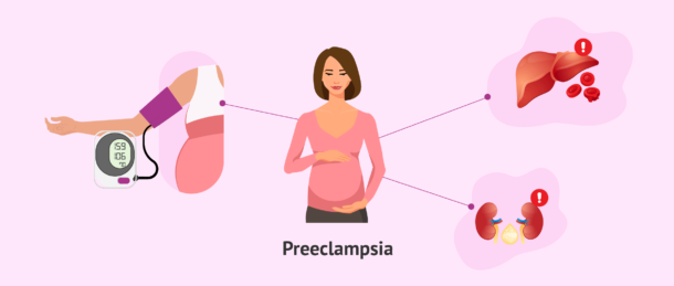 preeclampsia-what-is-it